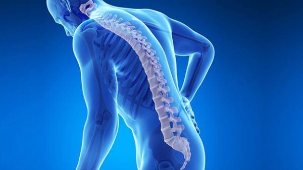 ti einai i osteoporosis