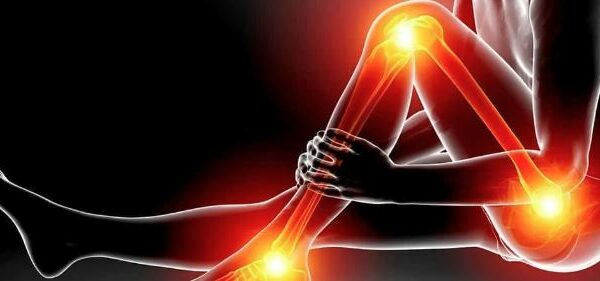 Το καλύτερο φάρμακο για ισχιαλγία 7 SCIATICA