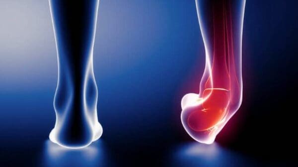 10 ασκήσεις για διάστρεμμα αστραγάλου 6 ankle sprain